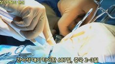 장기약탈 없다더니…中병원 “간이식 2~3일이면 가능”