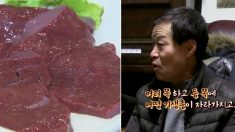 ‘소 생간’ 잘못 먹고 7번 대수술한 남성의 충격적인 사연