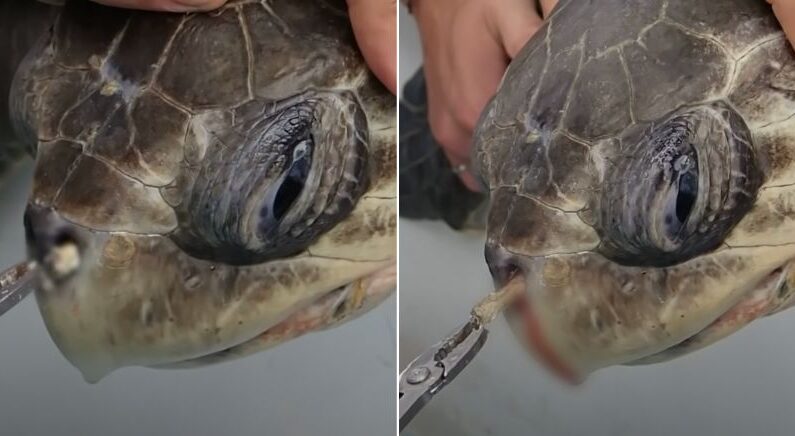바다 거북이 붙잡아 코에서 꺼낸것은…충격적인 정체