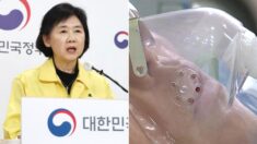 태국 다녀온 50대 남성, ‘뇌 먹는 아메바’ 감염돼 10일 만에 사망했다